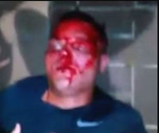 Christopher McKnight beaten by 40 black thugs in Cincinnati simply because he was White. July 2015